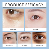Anti-Aging Eye Serum 3-Pack for Dark Circles & Eye Bags