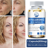 Hyaluronic Acid Anti Aging Hydrating 60 Capsules for Wrinkles - Joint Health