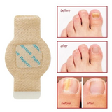 Toenail Fungus Care Patches Overnight Nail Treatment - 21 PCS
