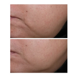 StriVectin Sculpting Face Moisturizer 2 Pack 1 oz