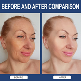 Hyaluronic Acid Anti Aging Hydrating 60 Capsules for Wrinkles - Joint Health